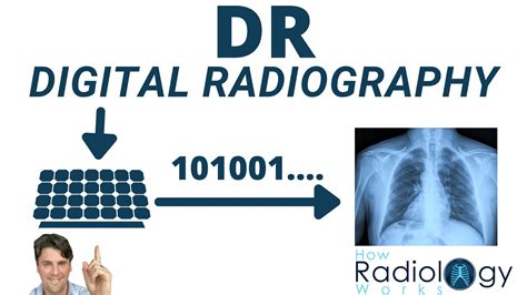 Direct Vs Indirect Digital Radiography Dr For Radiologic Technologists