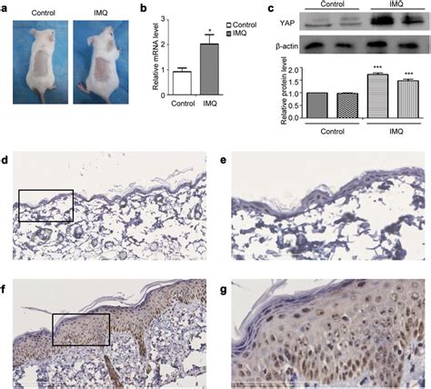 Yap Expression In The Imq Mouse Models A Gross Morphology Of Imq And