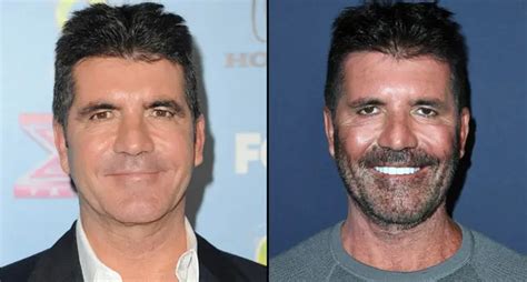 Simon Cowell Has A New Face Following Weight Loss And He Looks So