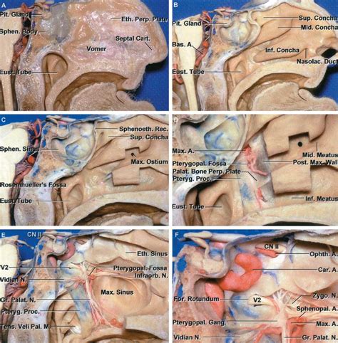Nasal Pathway To The Sphenoid Sinus Neuroanatomy The Neurosurgical