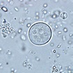 Entamoeba coli, cyst found in a wet prep | Parasitologia, Microbiologia ...