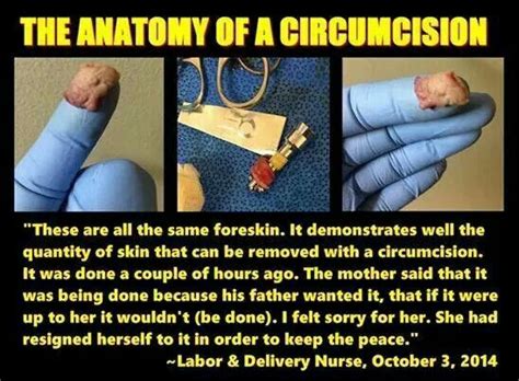 The Anatomy Of A Circumcision Circumcision Anatomy Sayings