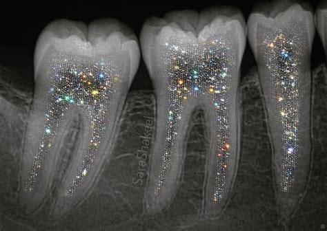 Sparkle Teeth Glitter Photography Glitter Art Dental Art