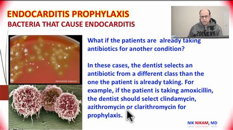Endocarditis Prophylaxis Update 2017 By Nik Nikam Md Mha Youtube