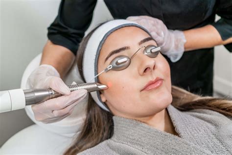 Photofacial Treatment In Scottsdale National Laser Institute Medical Spa