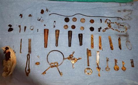 Stomach Surgery Reveals Keys Coins 80 Items