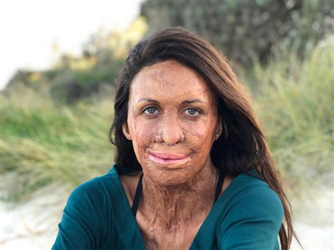 Turia Pitt How To Rewrite Your Own Story UnCover The University Of