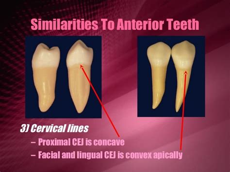 Maxillary Premolars