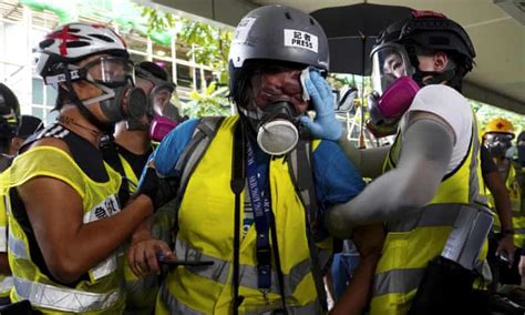 hong kong reporter blinded covering protests on her bid to sue police hong kong the guardian