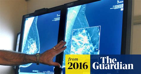 Mammograms May Be Missing Some Breast Cancers Study Shows Cancer