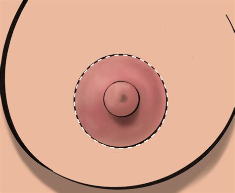 Nipple Areolar Reduction Adore Life