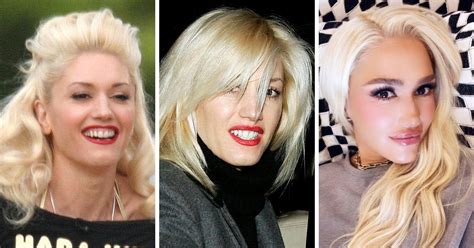 Gwen Stefanis Transformation Did The Singer Get Plastic Surgery