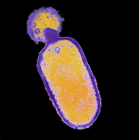 Listeria Monocytogenes Bacteria Photograph By Dr Kari Lounatmaa Science