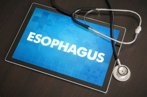 Esophageal Spasm Causes Symptoms And Natural Treatments