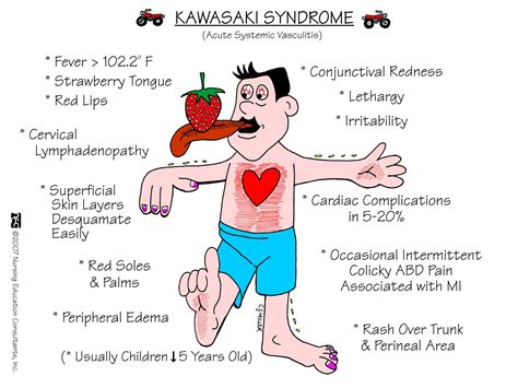 Nursing Mnemonics Medical Surgical Nursing Nursing Education