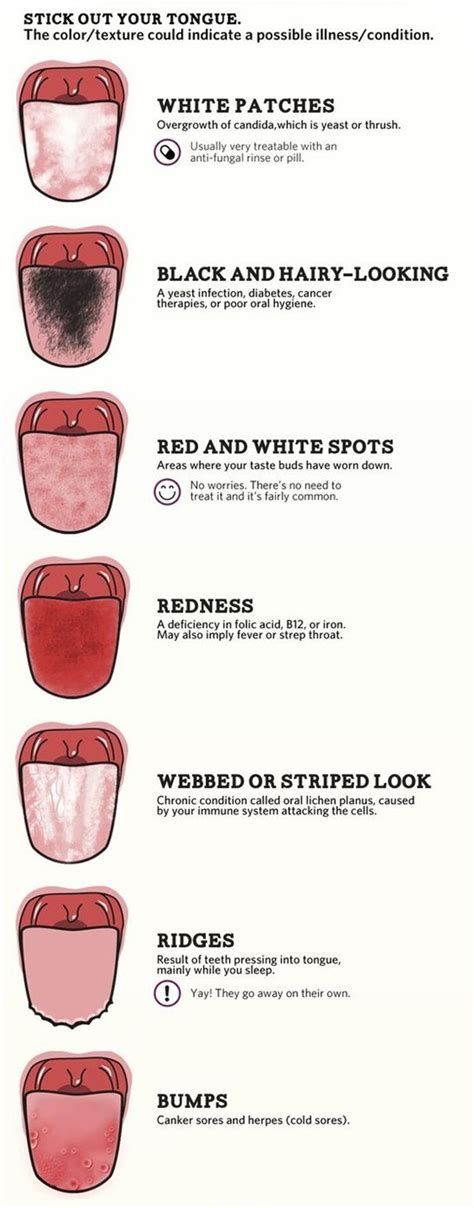 Tongue Color As An Indication Infographic Health Tongue Health Dental