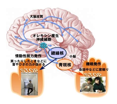 089オレキシン産生神経細胞は二つの異なる神経経路でナルコレプシーを抑制する 日本生理学会