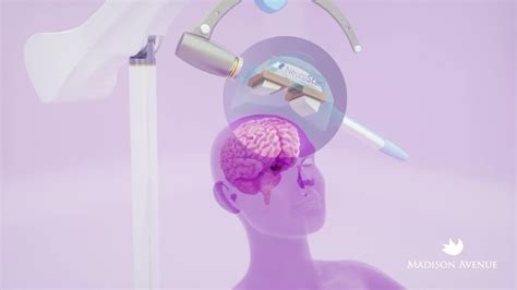 How Tms Works A Step By Step Explanation Of How Transcranial Magnetic