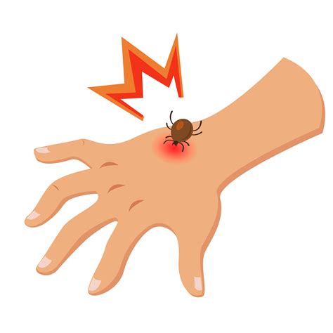 5 Misconceptions About Tick Bites And Lyme Disease Charlotte Parent