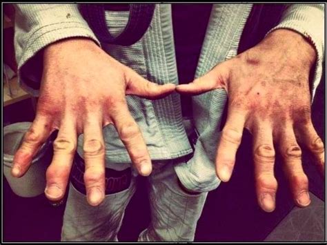 3 Ways To Protect Your Fingers When Doing BJJ And Judo Jiu Jitsu