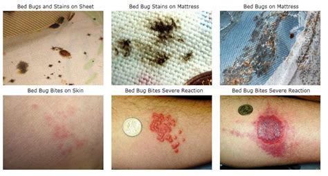 As the name indicates, bed bugs are often found in close proximity to beds. 2018 Guide to How to Kill Bedbugs: Step by Step Treatment Tips