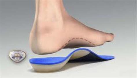 Things You Need To Know About Custom Orthotics