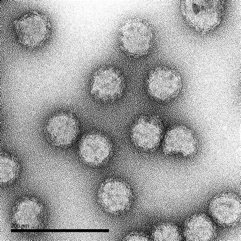 Onyongnyong Virus Vlp The Native Antigen Company