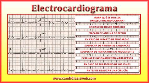 Pruebas Y Examenes Electrocardiograma