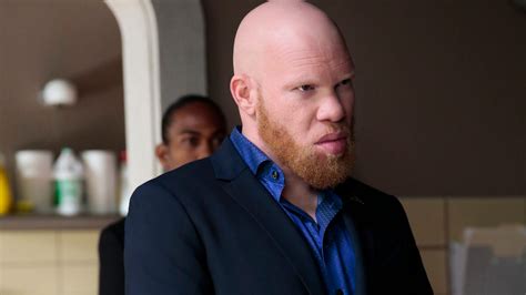 Black Lightnings Tobias Is Tvs First Villain With Albinism Tv Guide
