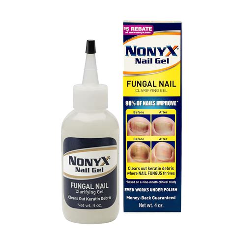 Buy Nonyx Fungal Nail Clarifying Gel A Toenail Fungus That Cleans Out Keratin Debris Where Nail