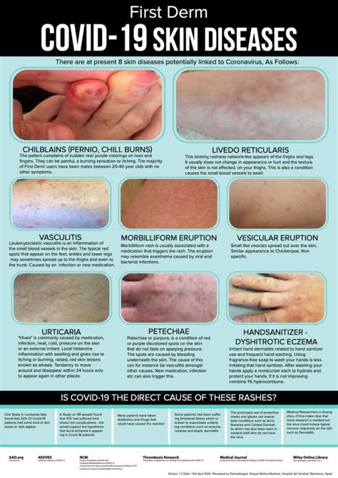 New Infographic Compares Rashes To Covid Toes Practical Dermatology