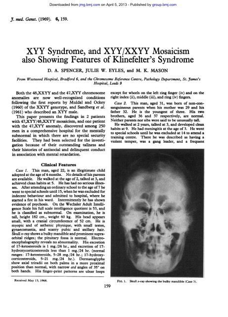 Syndrome Xxyy Unique The Rare Chromosome Disorder Support