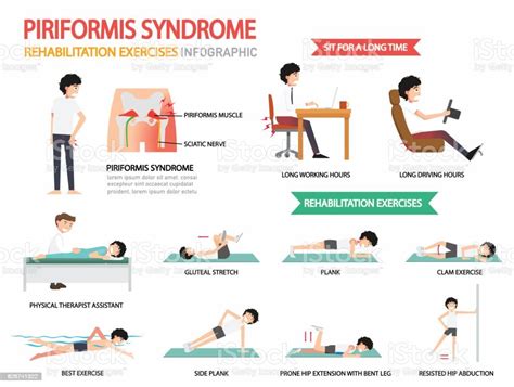 Piriformis Syndrome Rehabilitation Exercises Infographicillustration