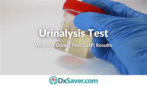 Urinalysis Testing Procedure Testing Cost And Results Interpretation