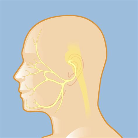 Hemifacial Spasm Brain Spine Center