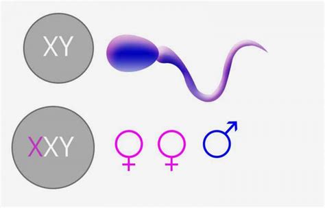 Xxy Syndrome Prominent Symptoms To Watch Out For