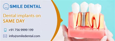 Dental Clinic Dilsukhnagar Dental Implants In Dilsukhnagar