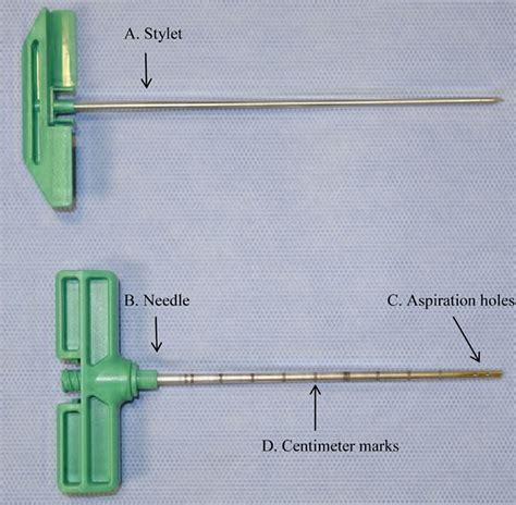 Core biopsy • myeloid cells • monocytic and dendritic. Bone Marrow Biopsy - Reasons, Pain, Complications