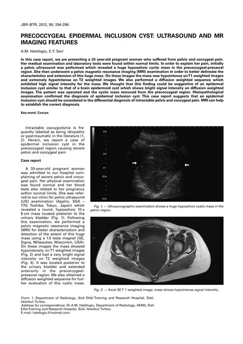 Pdf Precoccygeal Epidermal Inclusion Cyst Ultrasound And Mr Imaging