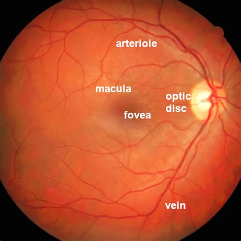 Retinal Circulation Visualized Through Fluorescein Angiography