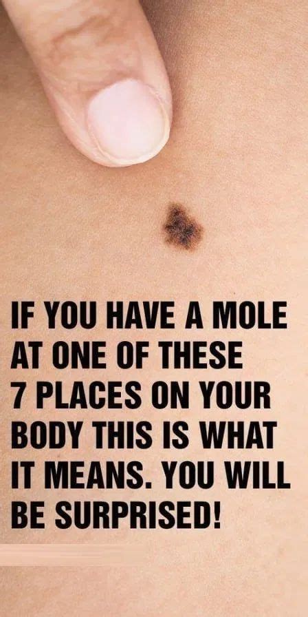 If You Have A Mole At One Of These 7 Places On Your Body This Is What