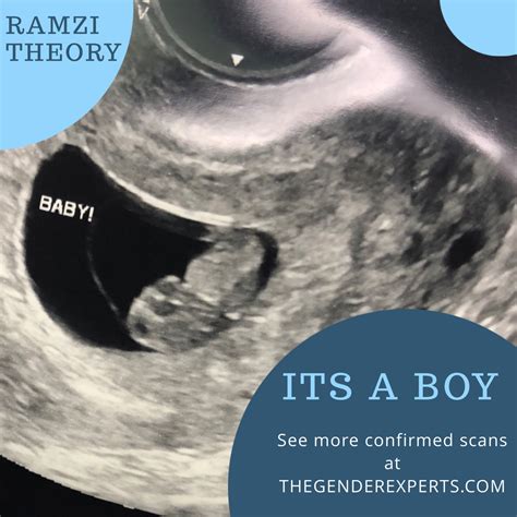 Confirmed Scans Gallery The Gender Experts Boy Ultrasound Pictures