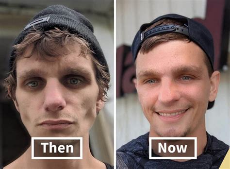 Before And After Drugs Telegraph