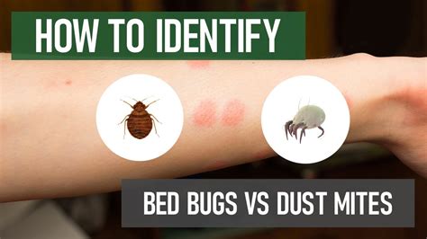 Do I Have Bed Bugs Or Dust Mites Diy Pest Control Youtube