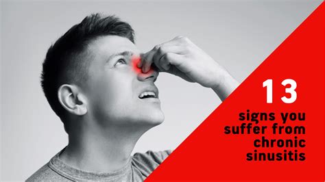 Common Signs And Symptoms That Indicate You Have Chronic Sinusitis