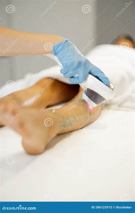 Laser Hair Removal Procedure On A Woman X S Legs Stock Image Image