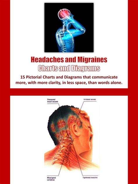 Headaches And Migraines Charts And Diagrams With Private Label Rights