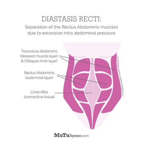 Mutu System Rectus Abdominis Muscle Healing Diastasis Recti Third