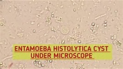 Entamoeba Histolytica (E.H)cyst under microscope.Stool Microscopy.Stool ...
