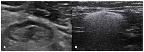 Medicina Free Full Text The Value Of Ultrasound In The Evaluation